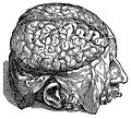 [picture: 606. The quivering brain.]